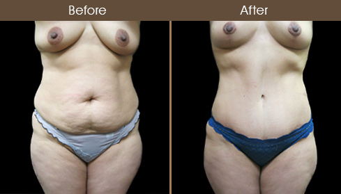 20202805154046_B157-front